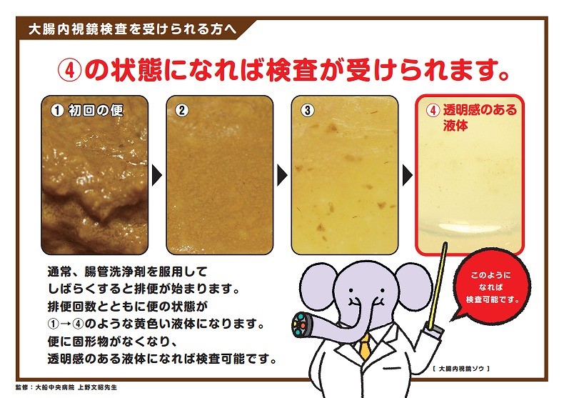 大腸内視鏡検査を受けられる方へ